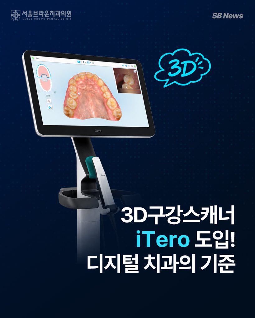 대전치아교정, 3D 구강스캐너 iTero 도입 | 서울브라운치과