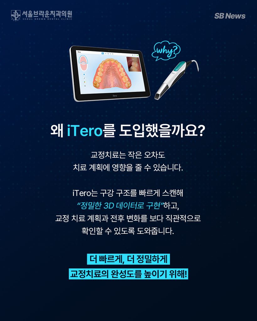 대전치아교정 iTero 구강스캐너를 활용한 3D 디지털 진단