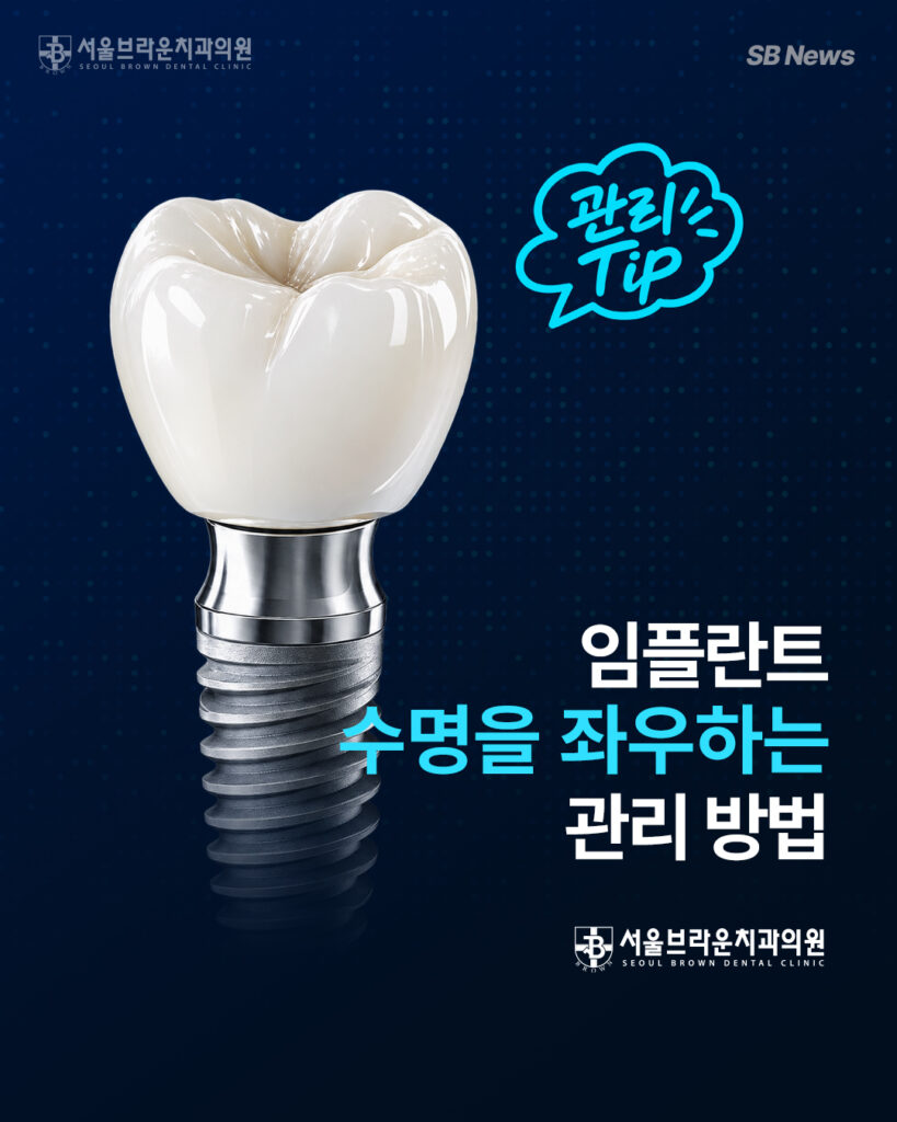 대전임플란트 수명을 좌우하는 관리 방법