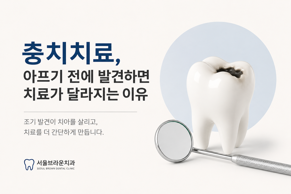 충치치료, 아프기 전에 발견하면 치료가 달라지는 이유