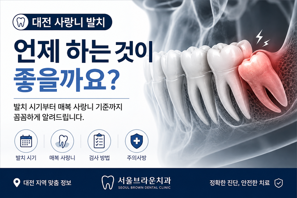 대전 사랑니 발치, 꼭 빼야 할까요? 발치 시기와 매복 사랑니 기준