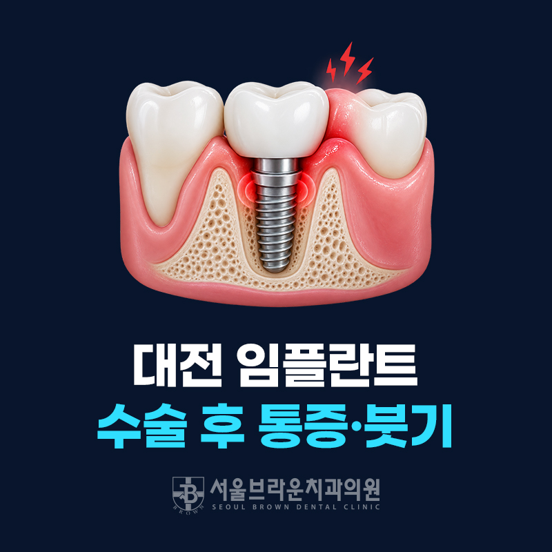대전임플란트 통증·붓기, 수술 후 얼마나 갈까요?