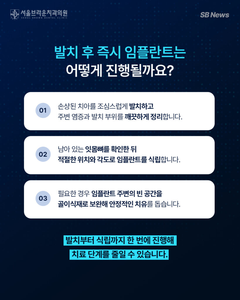 치아 발치 후 같은 날 발치 부위에 임플란트 픽스처를 식립하는 과정