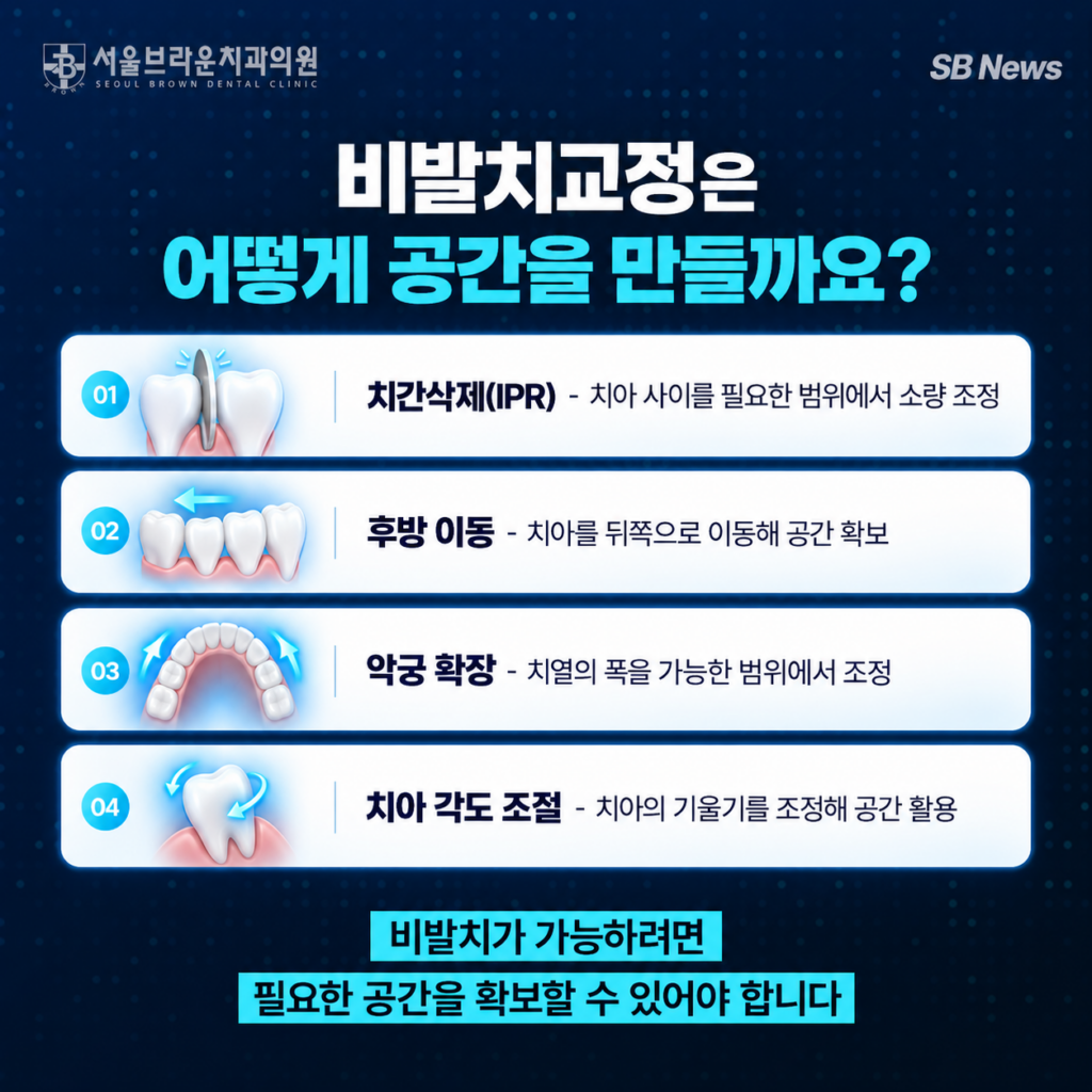 비발치교정에서 치간삭제, 후방 이동, 악궁 확장, 치아 각도 조절로 공간을 확보하는 방법을 설명하는 인포그래픽