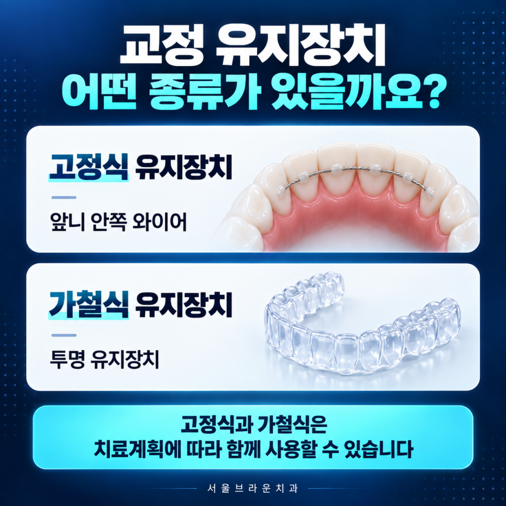 치아교정 후 사용하는 고정식 유지장치와 가철식 투명 유지장치의 차이를 비교한 이미지