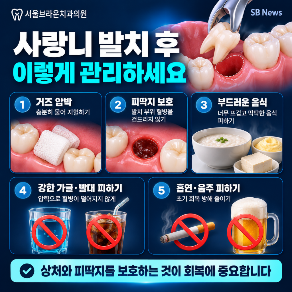 사랑니 발치 후 거즈 압박 혈병 보호 부드러운 음식 금연 등 주의사항을 설명하는 이미지