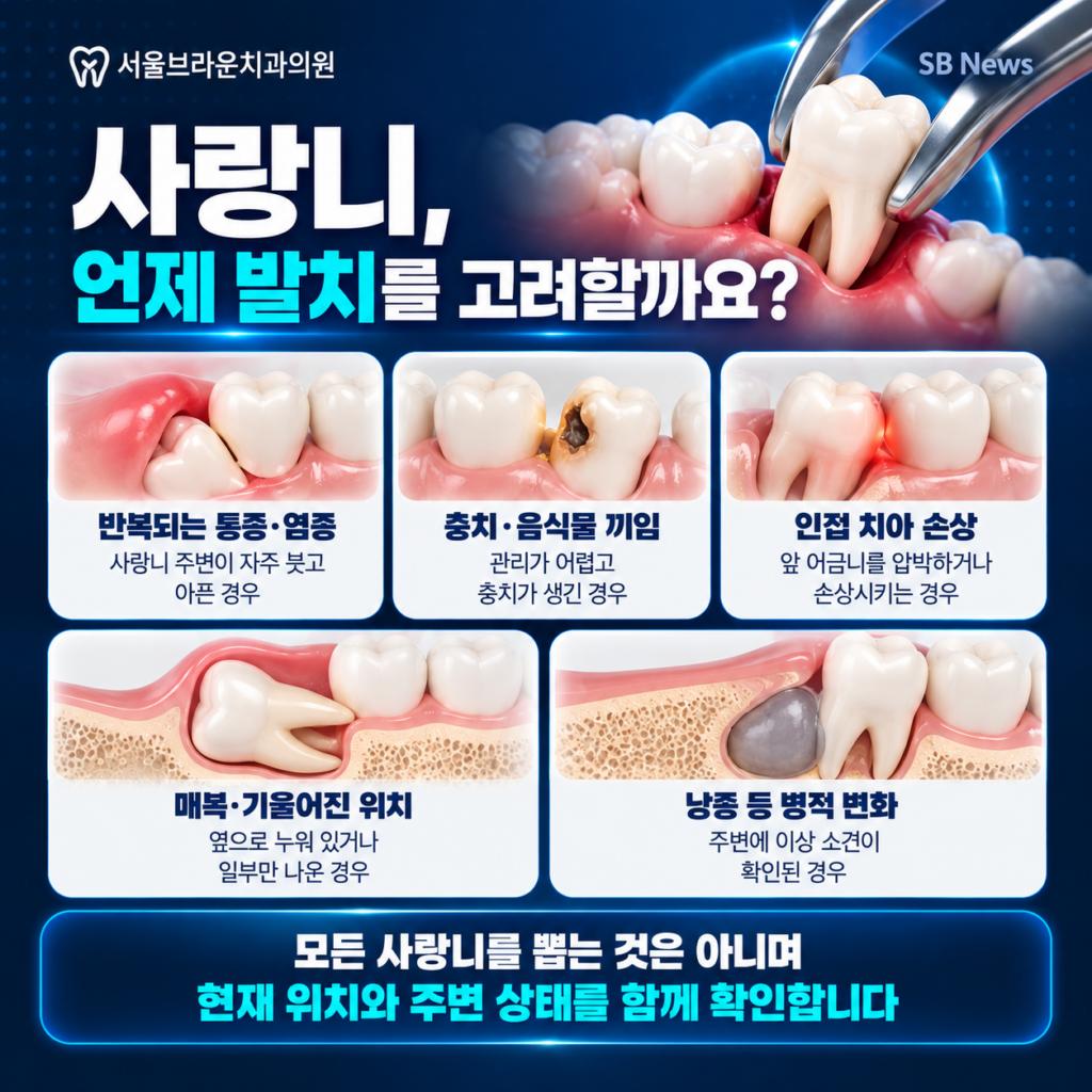 사랑니 통증 염증 충치 음식물 끼임 인접 치아 손상 등 발치를 고려하는 경우를 설명한 이미지