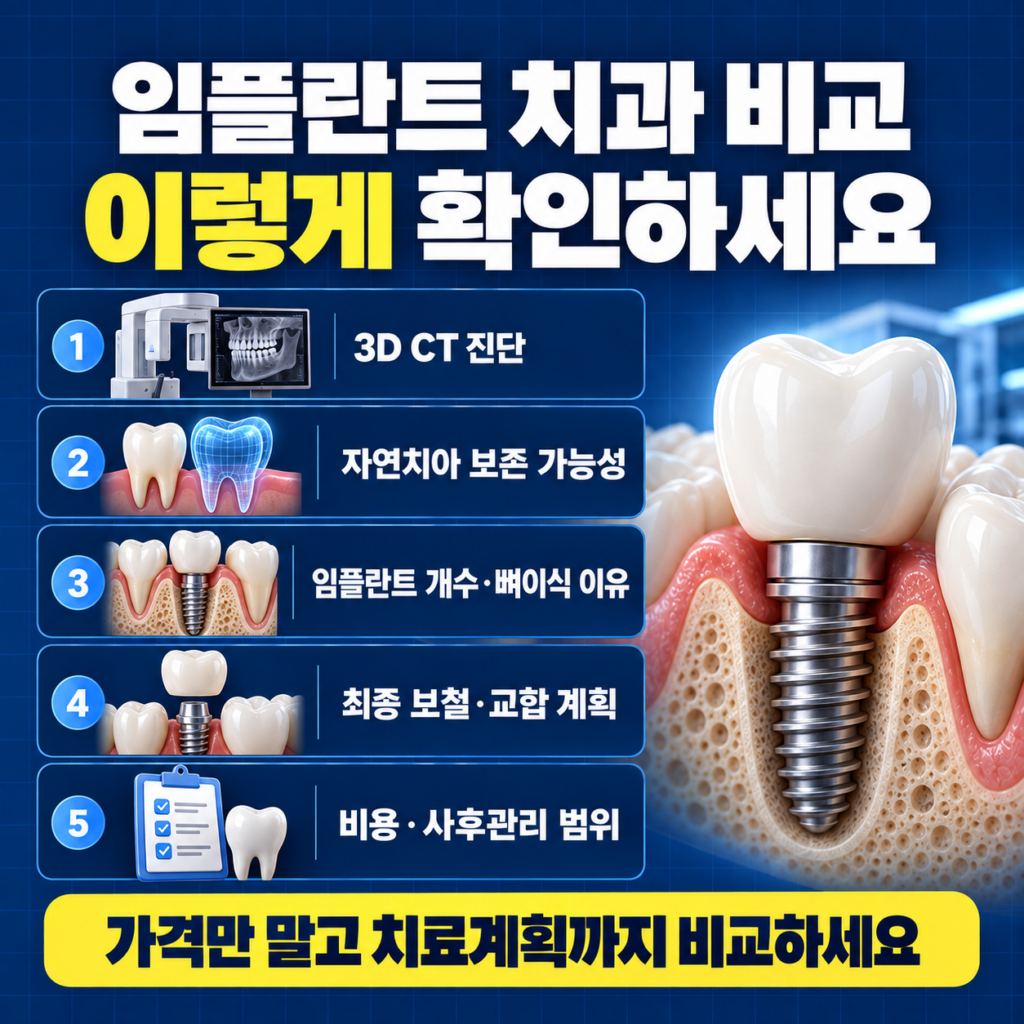 대전 임플란트 치과 비교 시 진단 자연치 보존 임플란트 개수 뼈이식 보철 비용과 사후관리를 확인하는 이미지