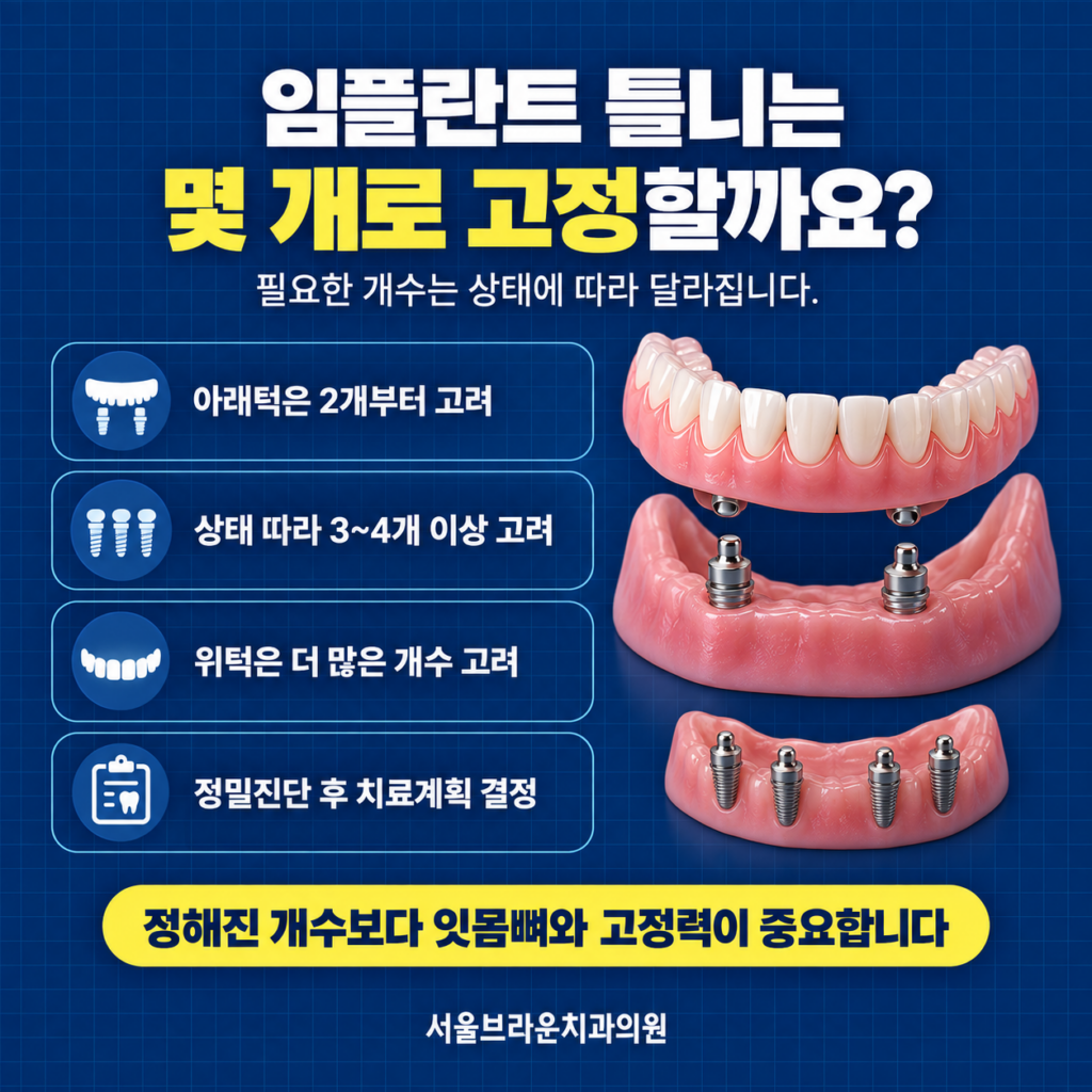 임플란트 몇 개로 틀니를 고정하는 방법, 대전에서도 가능할까요?