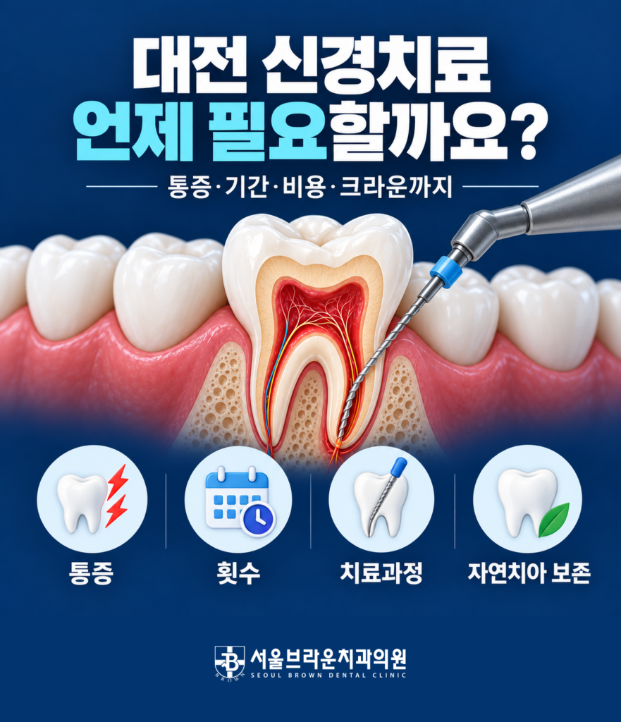 대전 신경치료가 필요한 증상과 근관치료를 알아보는 서울브라운치과 대표 이미지