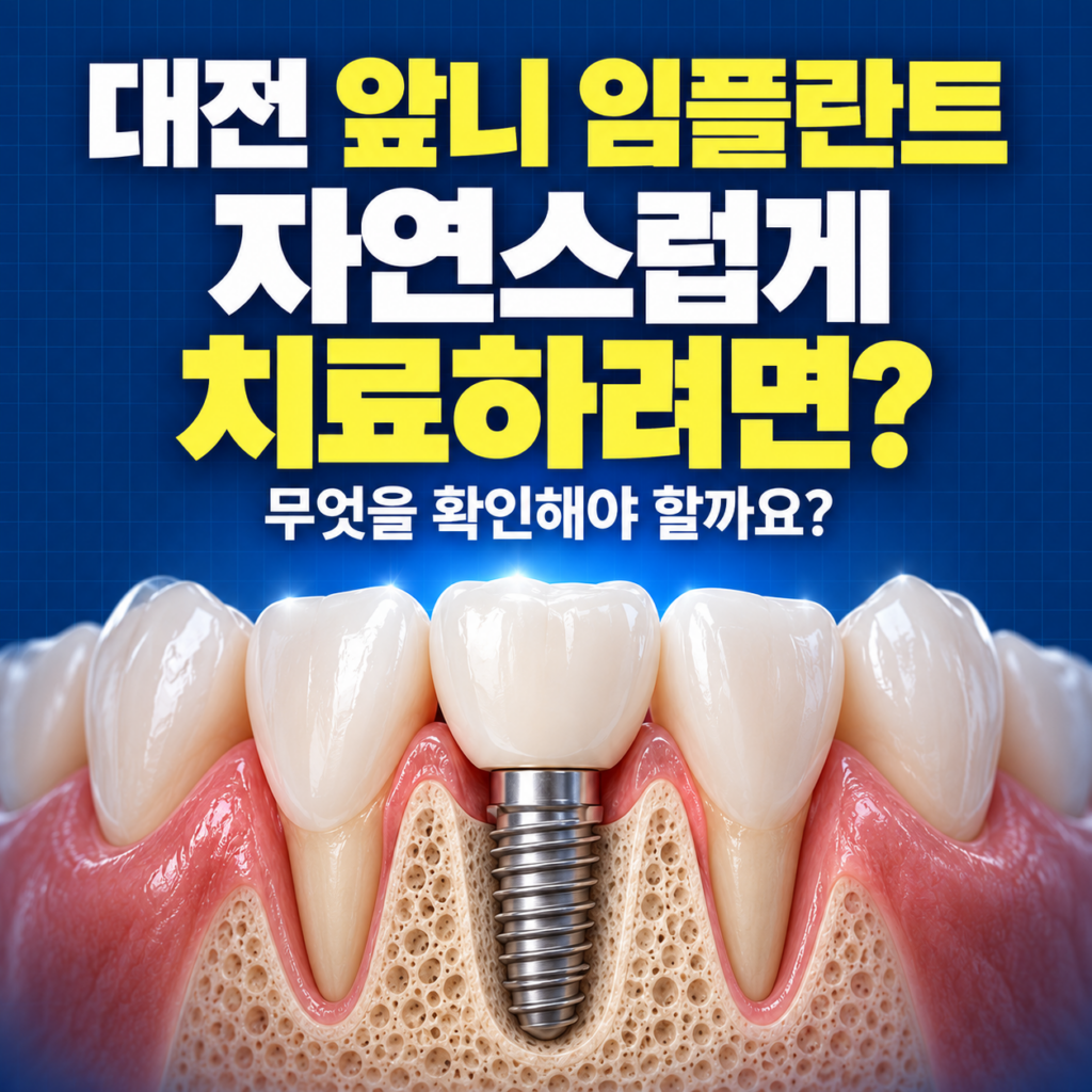 앞니가 빠져서 임플란트 해야 하는데, 대전에서 자연스럽게 치료하려면?