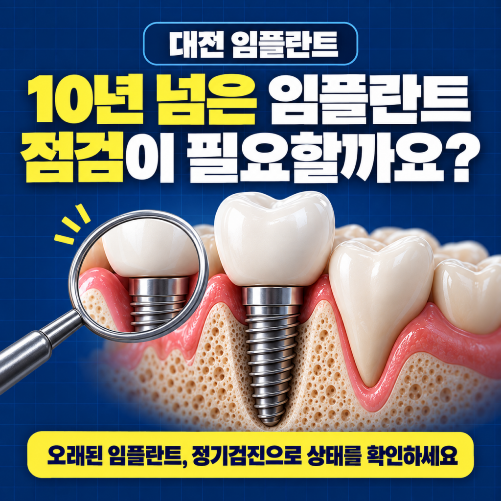 임플란트 한 지 10년 넘었는데, 대전에서 점검받을 치과 있을까요?