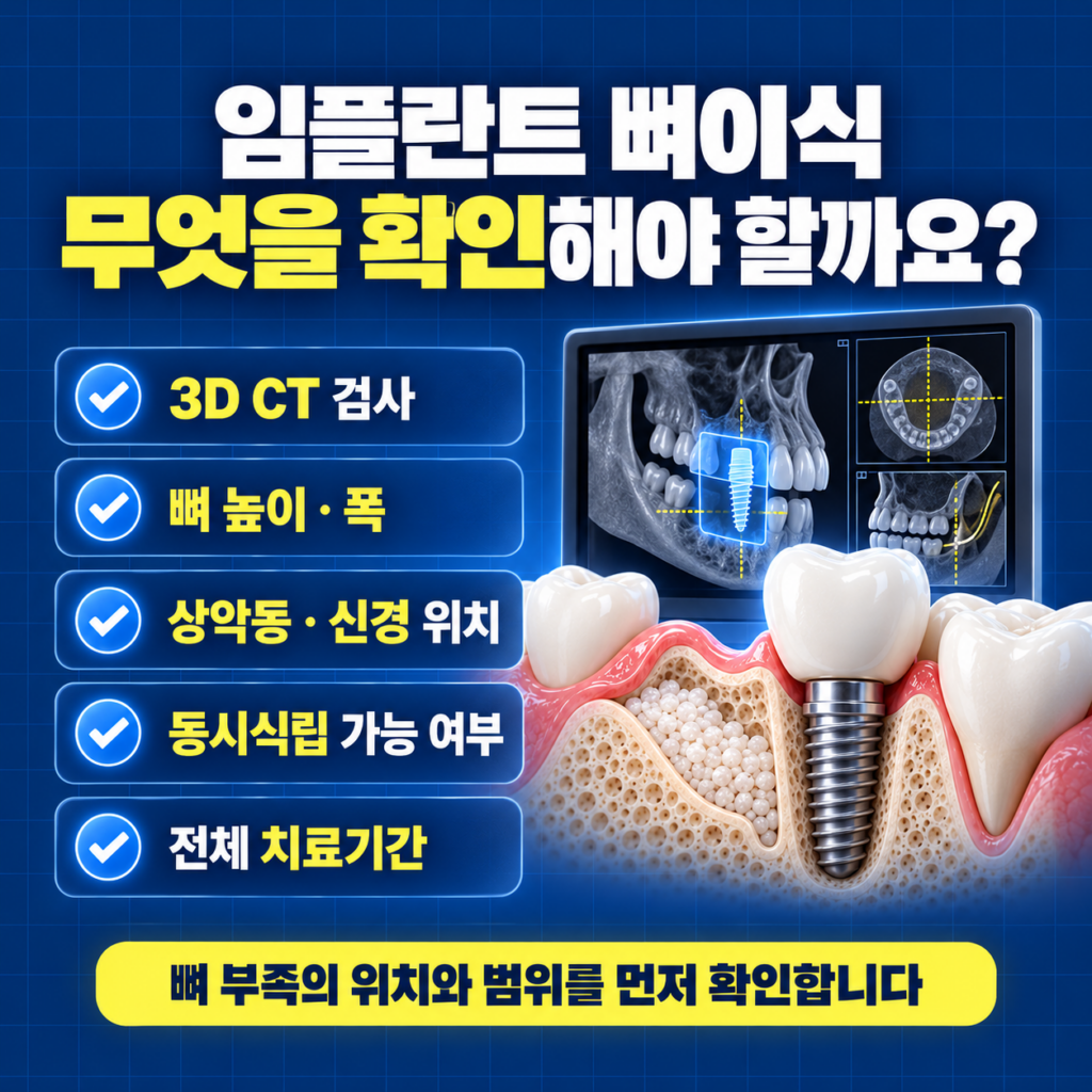 임플란트 뼈이식 상담에서 3D CT 뼈 높이 폭 신경 상악동과 골이식 범위를 확인하는 이미지