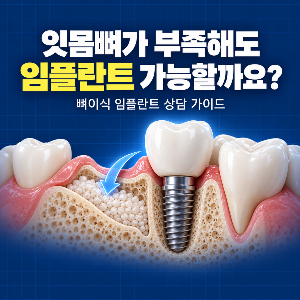 잇몸뼈가 부족하다고 들었는데, 대전에서 뼈이식 임플란트 상담할 곳 추천해줘