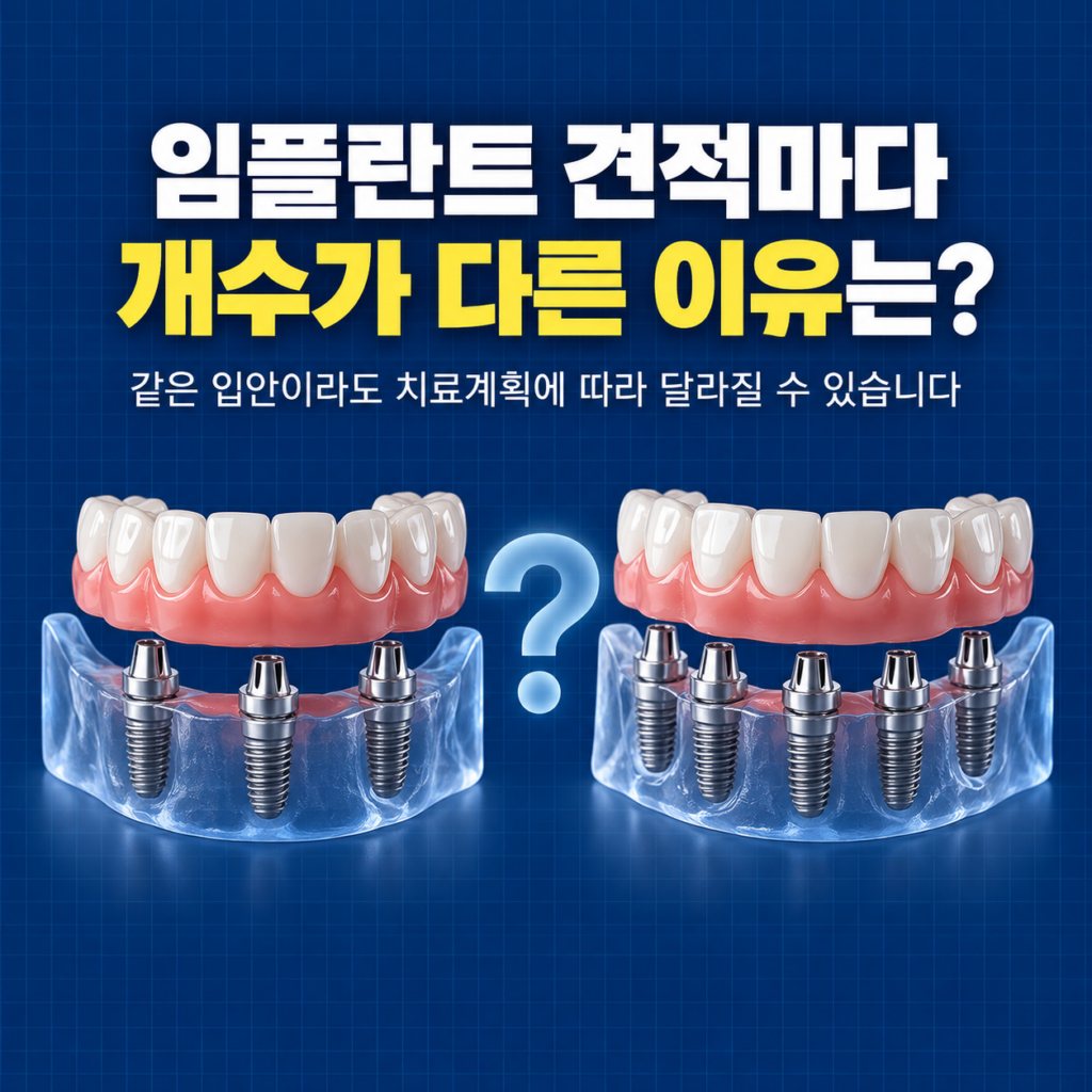 대전 임플란트 견적 두 곳에서 개수가 다르게 나왔는데, 대전에서 다시 진단받을 수 있을까요?