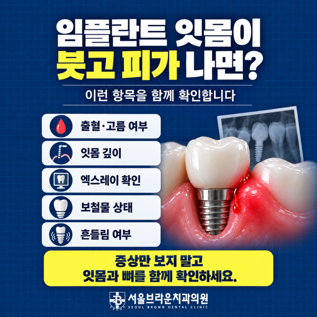 임플란트 잇몸 붓기와 출혈이 있을 때 잇몸 출혈 고름 잇몸 깊이 X-ray 잇몸뼈와 보철물 상태를 확인하는 이미지