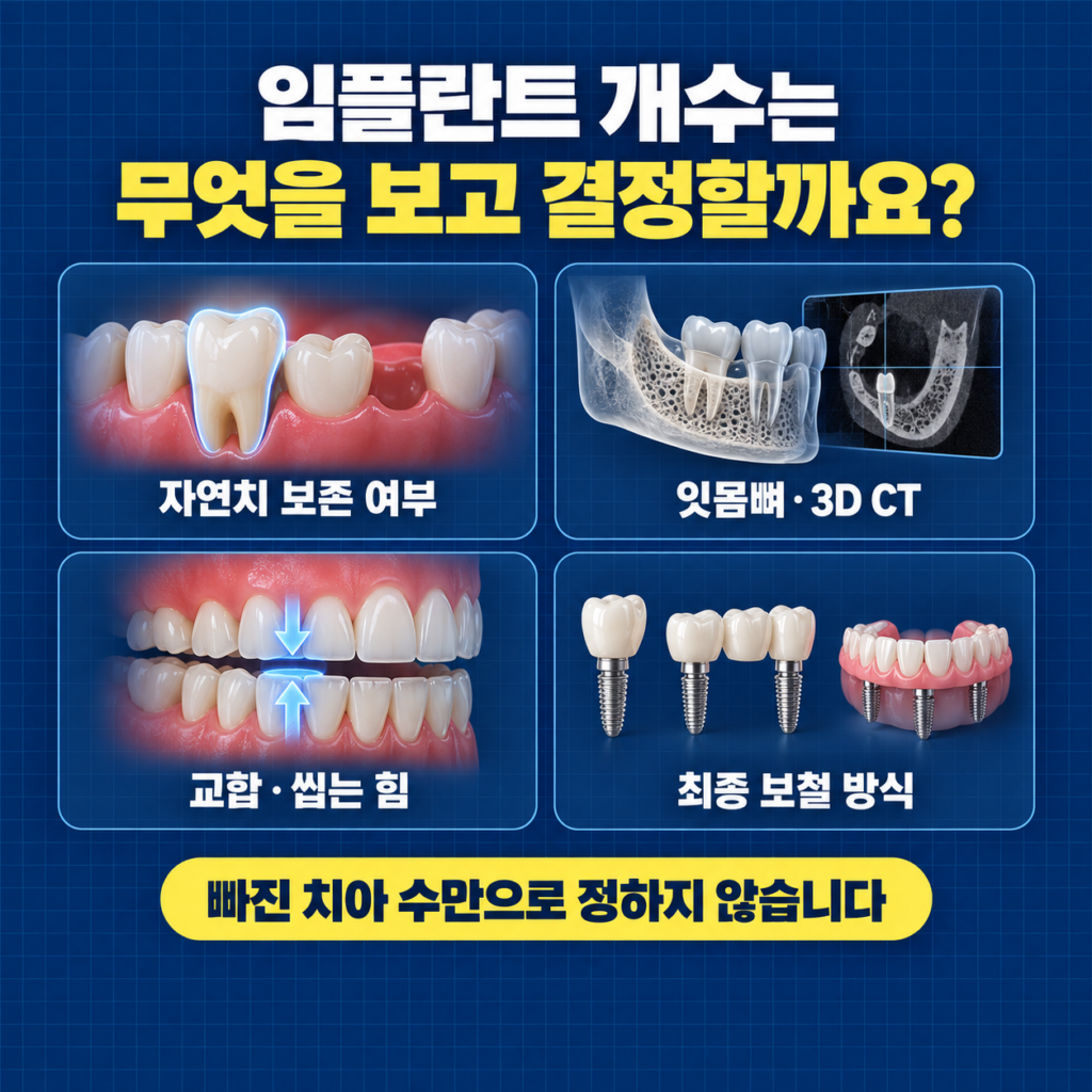 임플란트 개수를 결정할 때 자연치아 잇몸뼈 3D CT 교합과 최종 보철을 확인하는 이미지