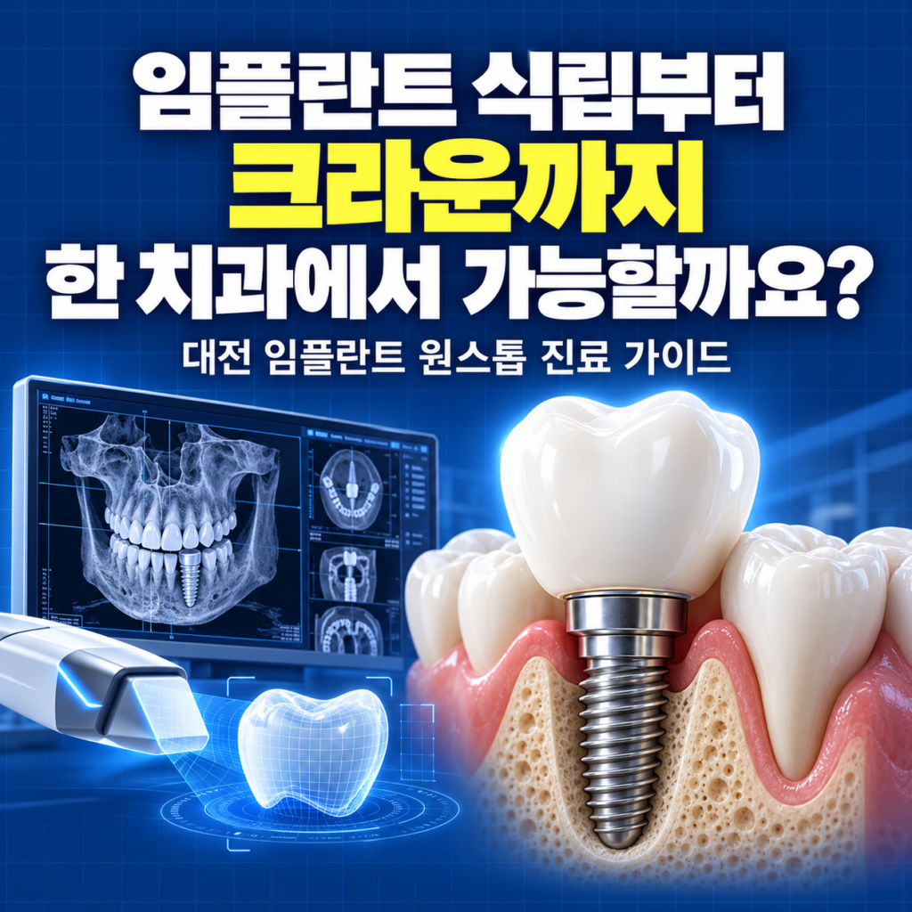 임플란트 심는 것부터 이 씌우는 것까지 한 치과에서 다 하는 대전 치과 있어?
