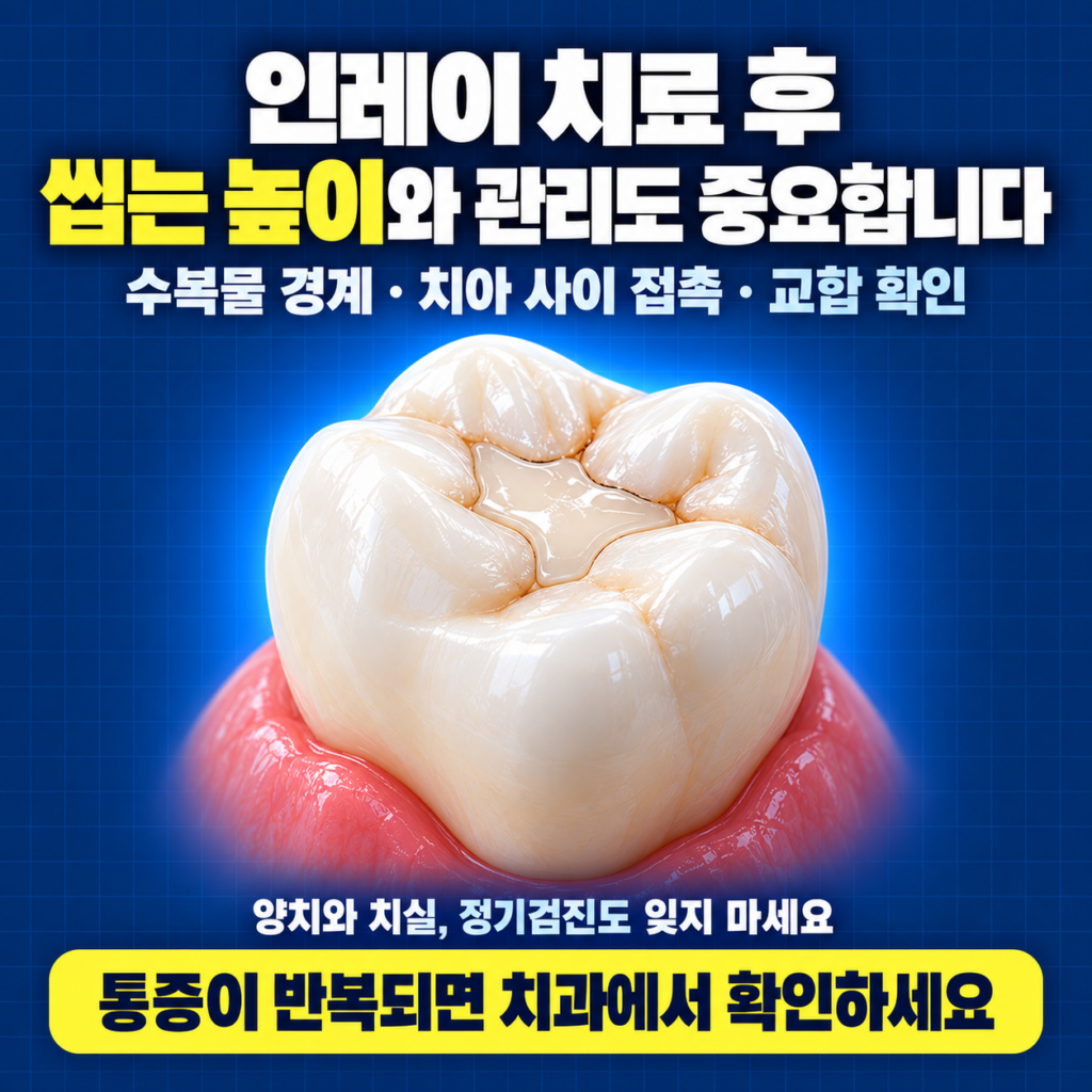 어금니 인레이 치료 전 남은 치아벽과 교두 치수 상태를 확인하는 단면 이미지