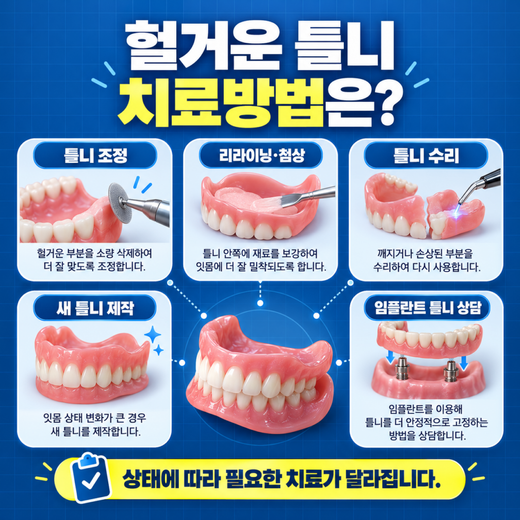 헐거운 틀니의 조정 첨상 수리 재제작과 임플란트 틀니 치료방법을 비교하는 이미지