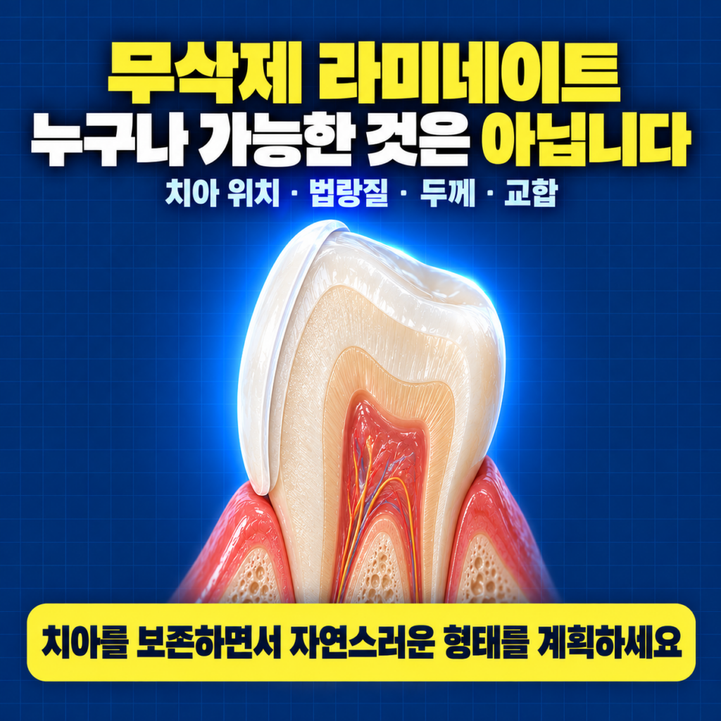 무삭제 라미네이트 가능성을 판단하기 위해 치아 위치와 법랑질 및 교합을 확인하는 이미지