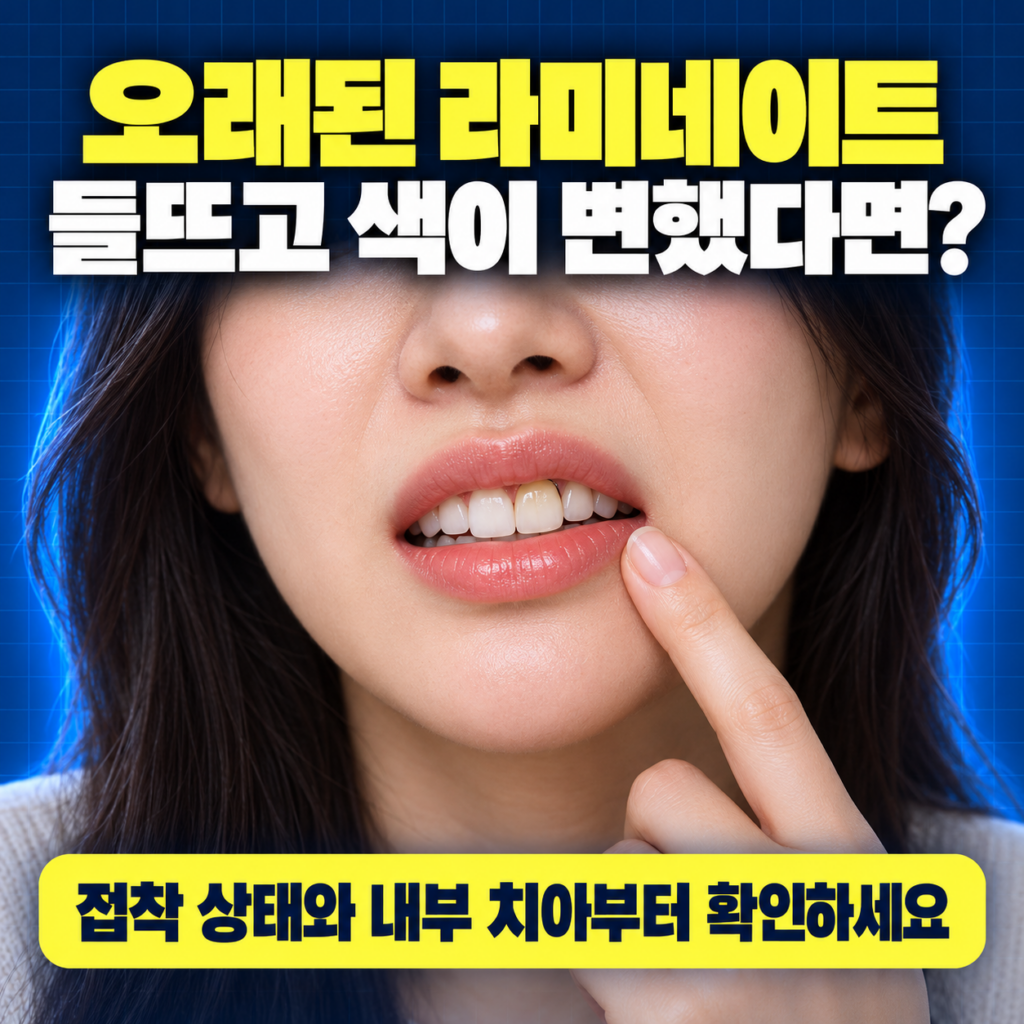 예전에 한 라미네이트가 들뜨고 색이 변했어. 대전에서 다시 해줄 치과 있어? 대전 라미네이트 재치료