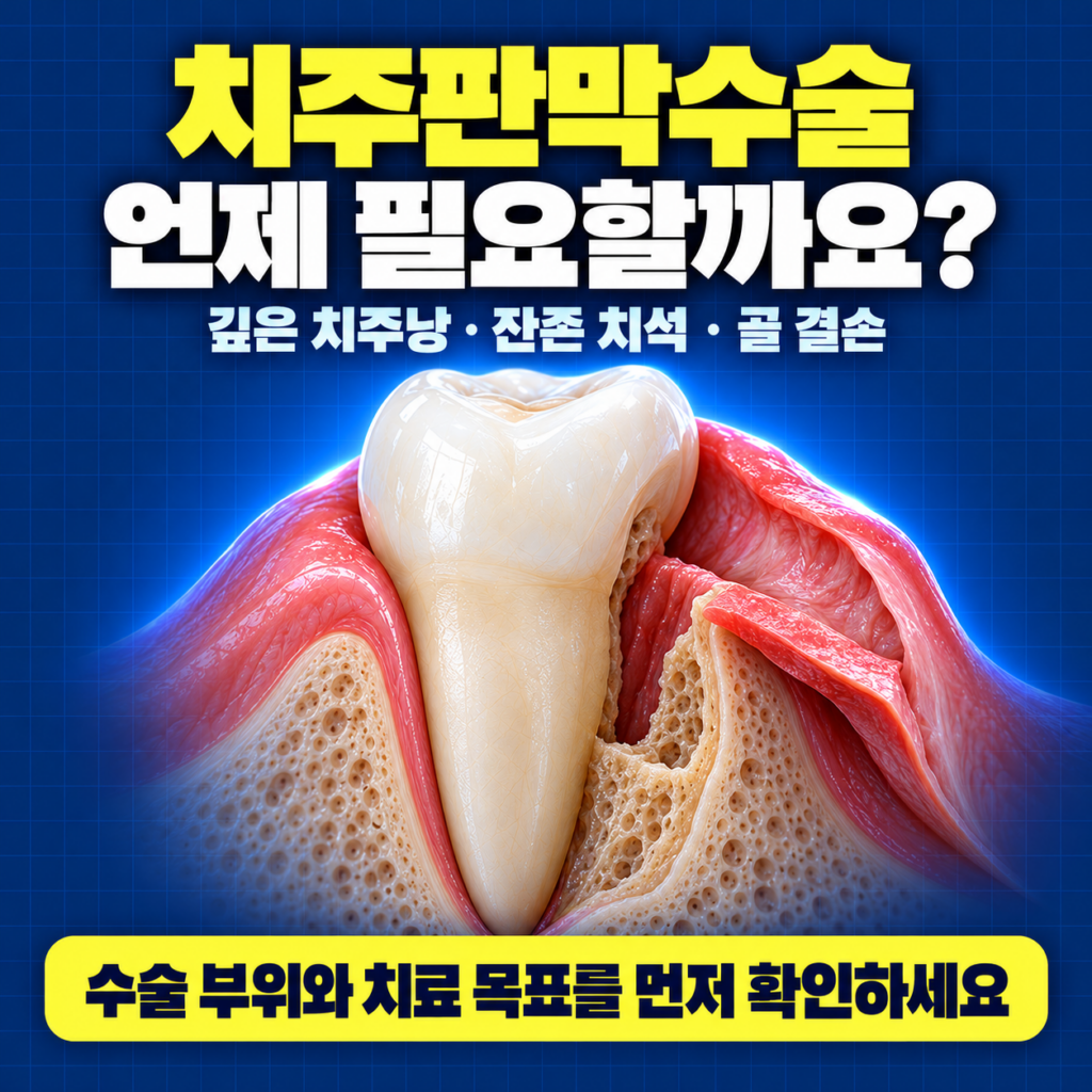 치주판막수술과 잇몸뼈 재생술 적용 기준