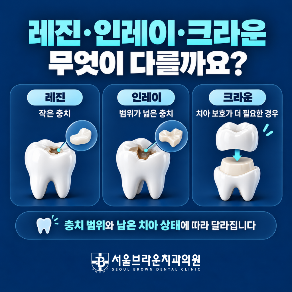 충치치료에서 레진 인레이 크라운의 치료 범위와 차이를 비교한 이미지