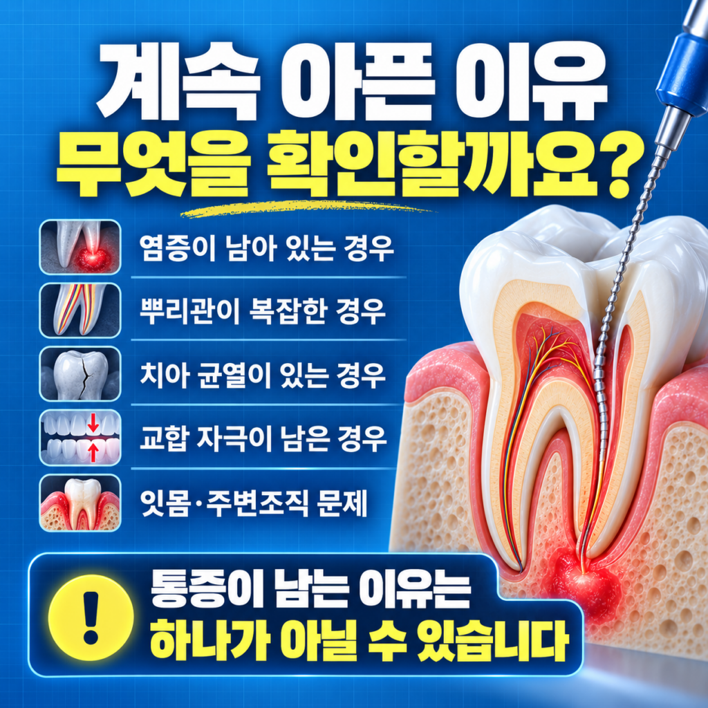 신경치료 후 지속되는 통증의 원인인 남은 감염 추가 근관 교합 치아 균열과 인접 치아 문제를 설명하는 이미지