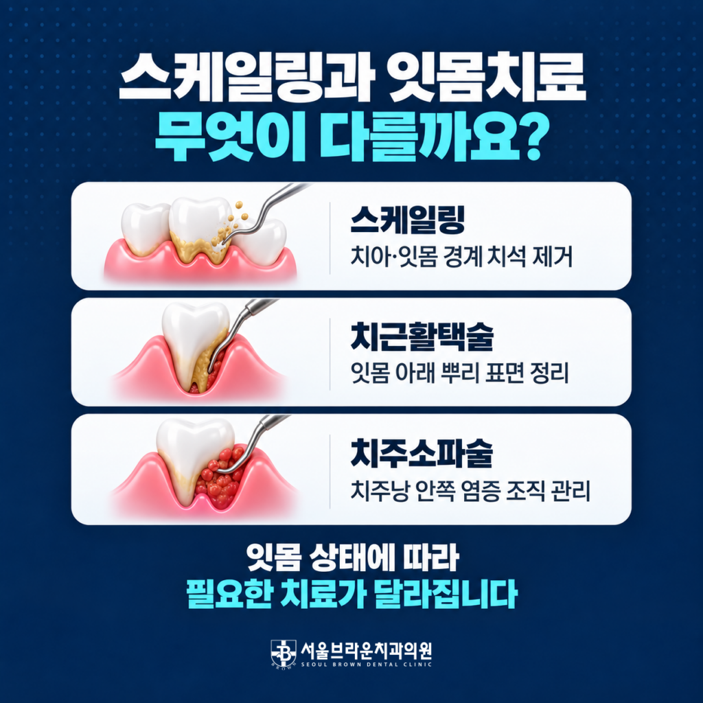 스케일링 치근활택술 치주소파술의 차이와 잇몸치료 과정을 비교한 이미지