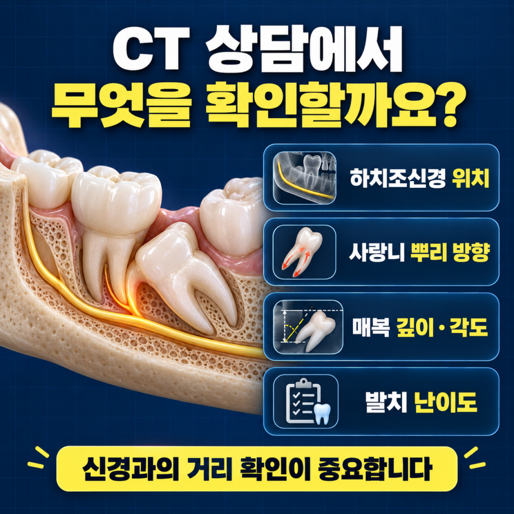 매복 사랑니 3D CT에서 뿌리 형태 매복 깊이 신경관 위치와 인접 어금니 관계를 확인하는 이미지