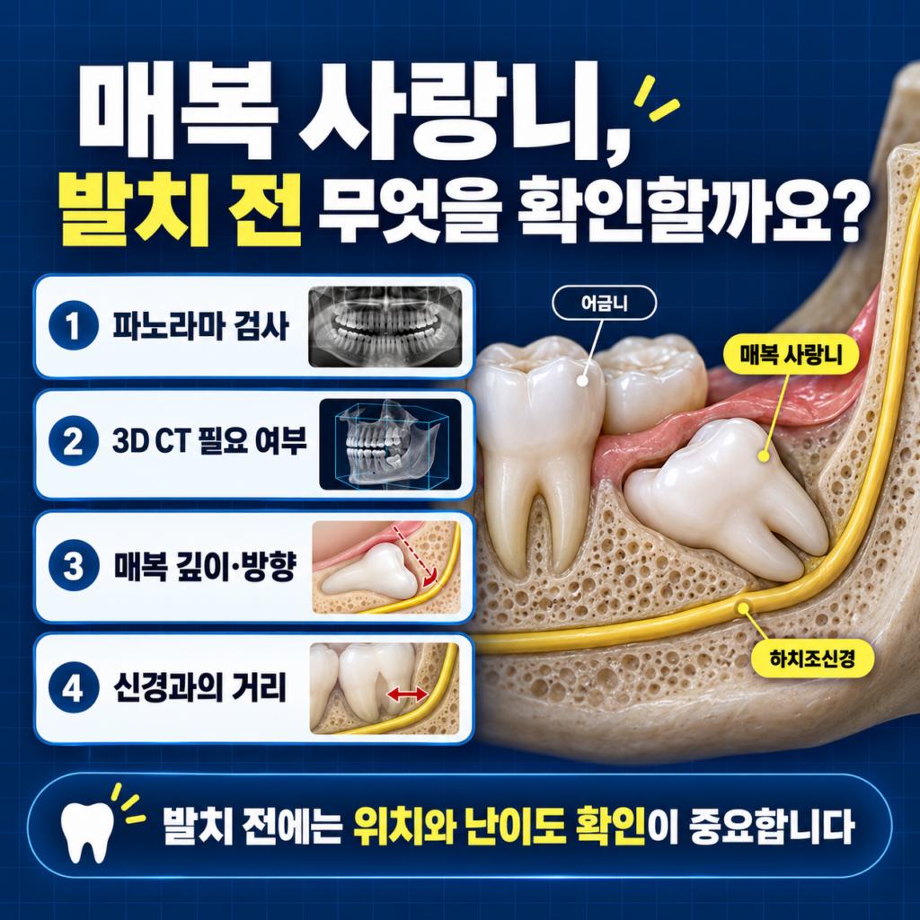 매복 사랑니 발치 전 파노라마 3D CT 매복 깊이 치아 뿌리와 신경 위치를 확인하는 이미지