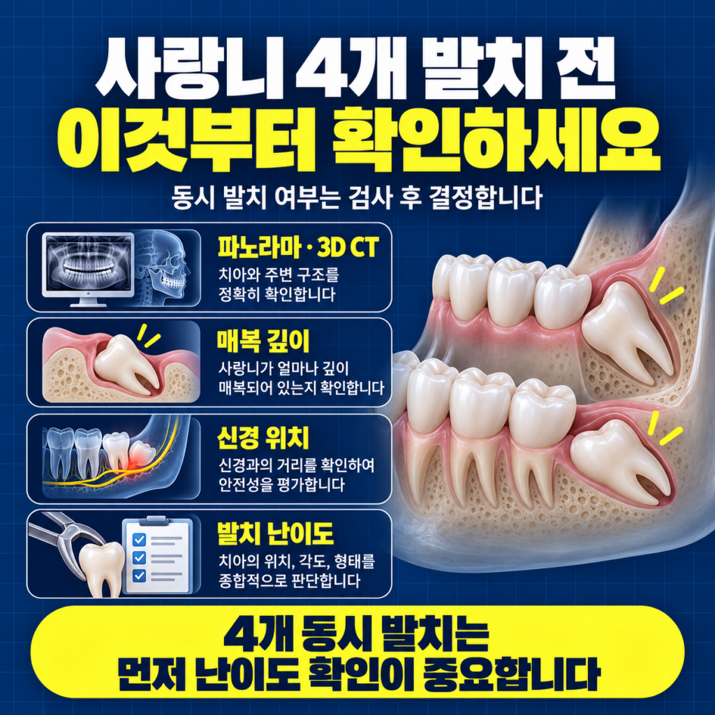 사랑니 4개 발치 전 파노라마 3D CT 매복 깊이 신경 위치와 발치 난이도를 확인하는 이미지
