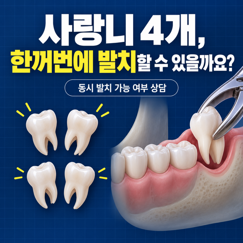대전 사랑니 발치, 사랑니 4개 한번에 빼고 싶은데, 대전에서 상담 가능한 치과 어디야?