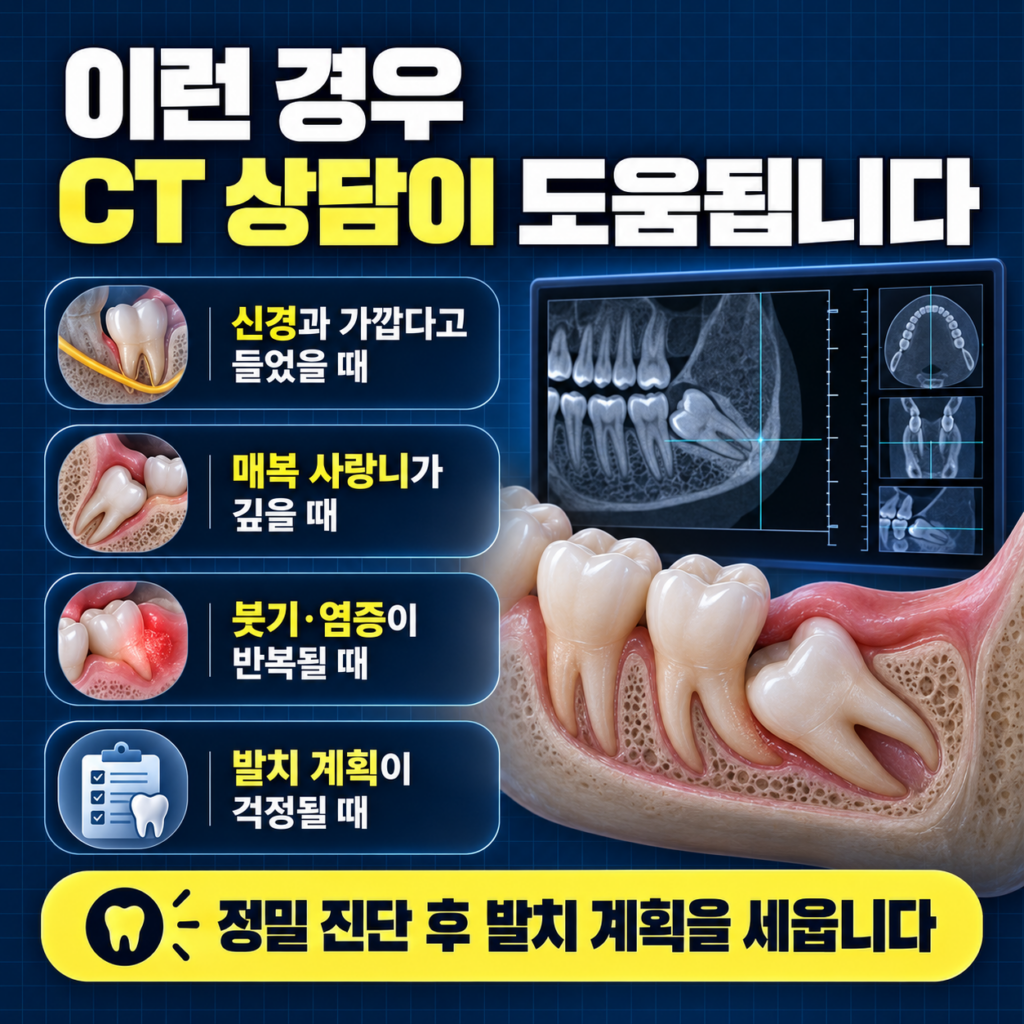 대전 사랑니 발치, 사랑니가 신경이랑 가깝다고 들었는데, 대전에서 CT 찍고 상담할 곳 있어?